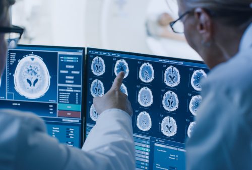 In Control Room Doctor and Radiologist Discuss Diagnosis while Watching Procedure and Monitors Showing Brain Scans Results, In the Background Patient Undergoes MRI or CT Scan Procedure.