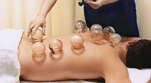 5.CUPPING THERAPY